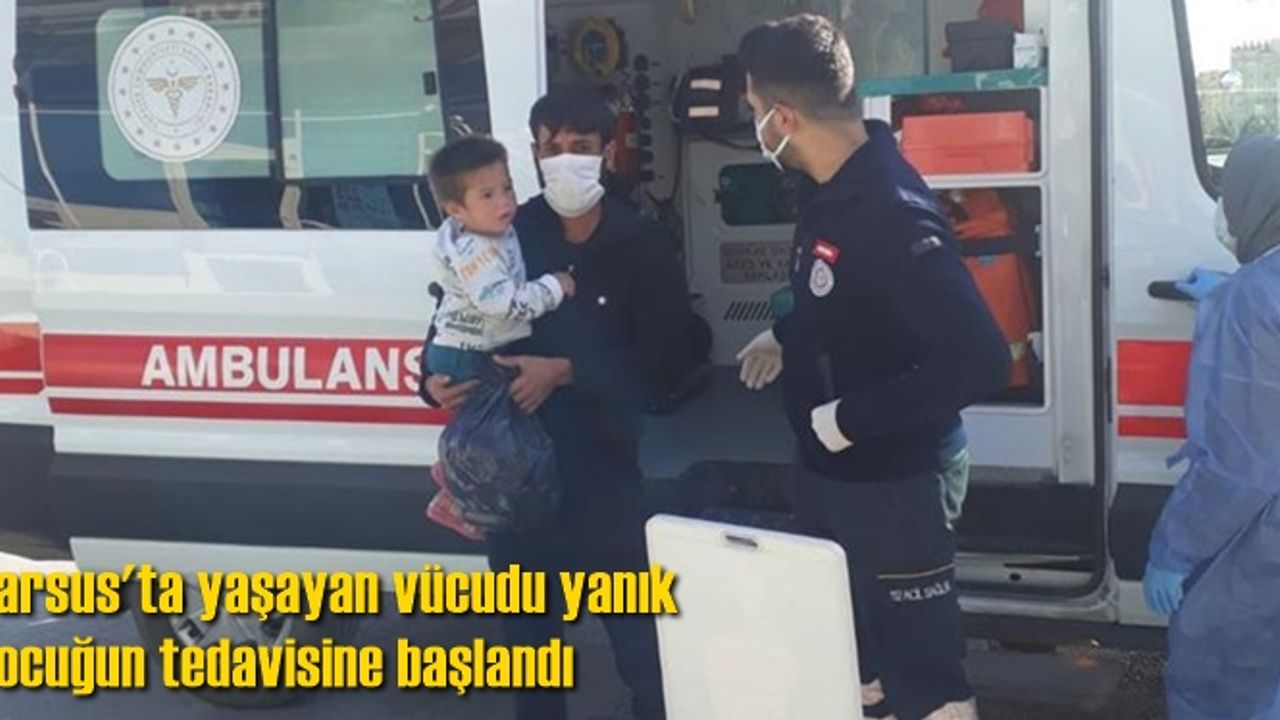 Tarsus'ta yaşayan vücudu yanık çocuğun tedavisine başlandı